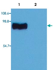 MAB3602 - STIM1 / GOK