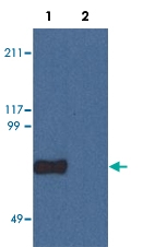 MAB3603 - Copine-7
