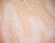 MAB3610 - PSMA / FOLH1