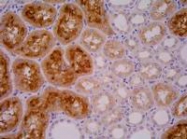MAB3610 - PSMA / FOLH1