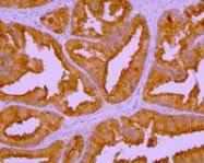 MAB3610 - PSMA / FOLH1