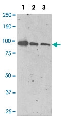 MAB3610 - PSMA / FOLH1