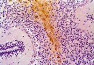 MAB3612 - GFAP
