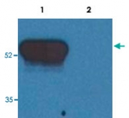 MAB3613 - GFAP