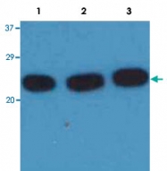 MAB3617 - HRAS