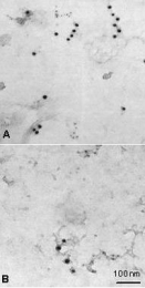MAB3623 - LAT