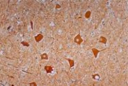 MAB3638 - Neurofilament H (200 kD)