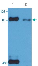 MAB3641 - STAT1