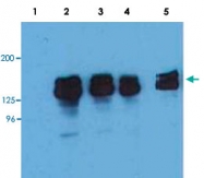 MAB3645 - INPP5D