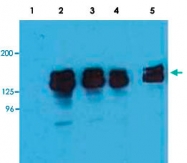 MAB3646 - INPP5D