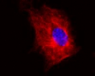 MAB3656 - TUBB1