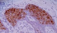 MAB3663 - Cytokeratin 10