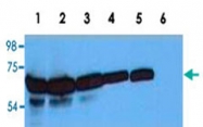 MAB3664 - ZAP70