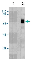 MAB3711 - Perforin 1 / PRF1