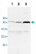 MAB3727 - RIPK2