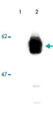 MAB3728 - RIPK3 / RIP3