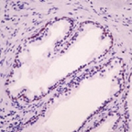 MAB3785 - SERPINB5 / Maspin