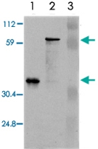 MAB3794 - uPA / PLAU