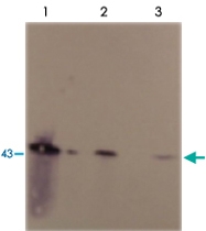 MAB3806 - SERPINE1 / PAI1