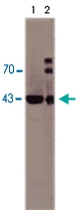 MAB3808 - SERPINE1 / PAI1