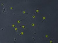 MAB3824 - ACRV1