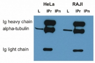 MAB3826 - alpha Tubulin / TUBA1B