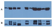 MAB3826 - alpha Tubulin / TUBA1B