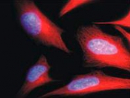 MAB3826 - alpha Tubulin / TUBA1B