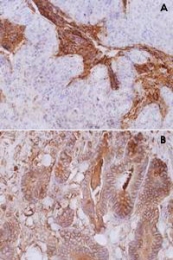 MAB3848 - CD66e / CEACAM5