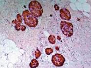 MAB3849 - Insulin