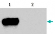 MAB3860 - CD222 / IGF2R