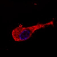 MAB3872 - Neurofilament M (160 kD)