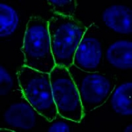 MAB3877 - TNFRSF21 / Death receptor 6 (DR6)