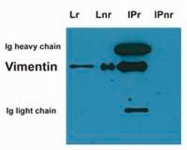 MAB3880 - Vimentin