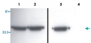 MAB3880 - Vimentin