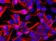 MAB3880 - Vimentin