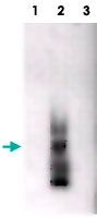 MAB3915 - Amyloid beta