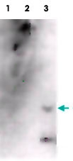 MAB3916 - Amyloid beta