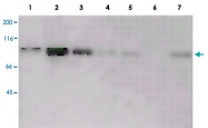 MAB3925 - Catenin beta-1