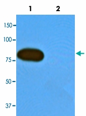 MAB4201 - Herpes Virus Type 8 / HHV8