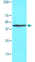 MAB4202 - HOMER1