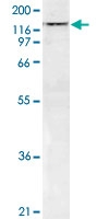MAB4948 - SMARCA5