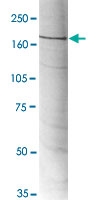 MAB4949 - RSF1
