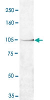 MAB4950 - SIRT1