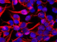 MAB5029 - Vimentin
