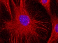 MAB5029 - Vimentin