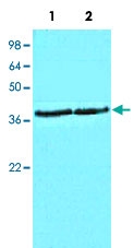 MAB5378 - CSNK1A1