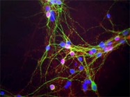 MAB5383 - Alpha-Synuclein / SNCA