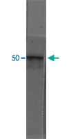 MAB5384 - GFAP