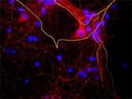 MAB5386 - Neurofilament H (200 kD)